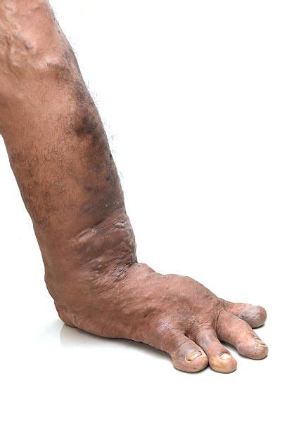 ugly feet pictures